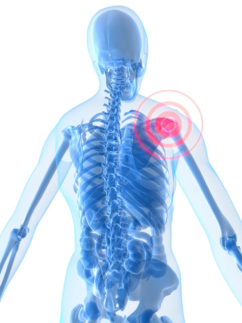 Skeleton diagraming shoulder pain